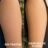 Crema para Piel de Fresa