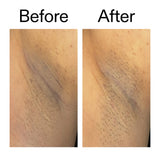 Glycolic Acid Exfoliating Body Stick